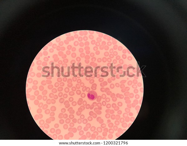 Monocyte Neutrophil Cell Blood Smear Analyze Stock Photo 1200321796