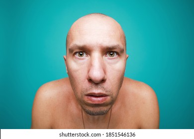 Portrait Funny Naked Bald Man Isolated Stock Photo Edit Now