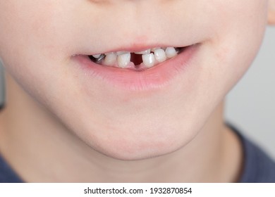 29 978 First Tooth Images Stock Photos Vectors Shutterstock