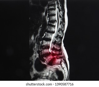 Sagittal Projection Magnetic Resonance Image Mri Stock Photo Edit Now