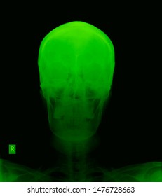 Schedel Ap Radiograph Skull Head Neck Stock Photo Shutterstock