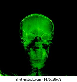 Schedel Ap Radiograph Skull Head Neck Stock Photo Shutterstock