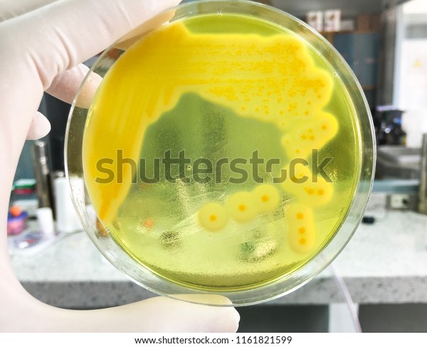 Staphylococcus Aureus Grow On Mannitol Salt Stock Photo 1161821599