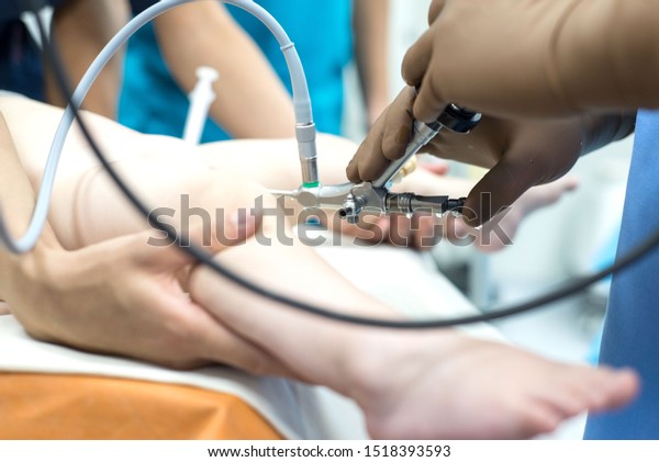 Team Urologist Doctors Performing Cystoscopy Using Stock Photo