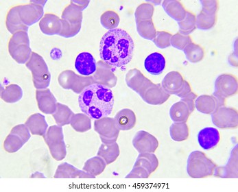 White Blood Cell Peripheral Blood Smear Stock Photo Edit Now