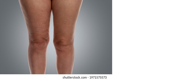 Womens Naked Butts Stock Photos Images Photography Shutterstock