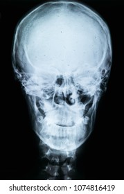 Xray Human Skull Xray Image Concept Stock Photo 1074816419 Shutterstock