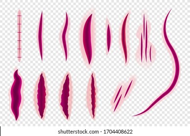 Bloody Scar Realistic Wounds Stitch Skin Stock Vector Royalty Free