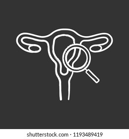 Gynecological Exam Glyph Icon Female Reproductive Stock Vector Royalty