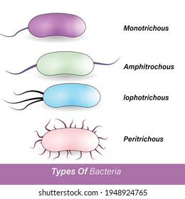 Chromogen Images Stock Photos Vectors Shutterstock