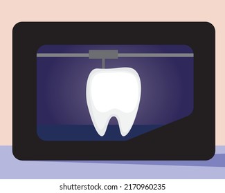 Molar Tooth 3d Printer Flat Vector Stock Vector Royalty Free