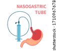 Nasogastric Tube Images Stock Photos D Objects Vectors