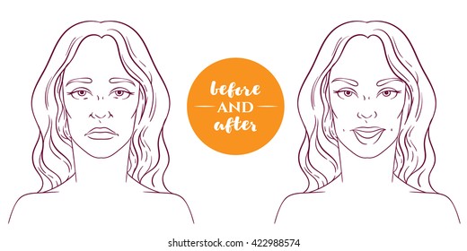 Portrait Woman Before After Cosmetic Defects Stock Vector Royalty Free