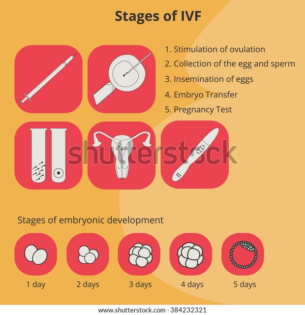 Stages Vitro Fertilization Infographics Process Icons Stock Vector