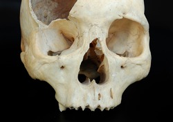 Old broken skull against black. Brocken human skull isolated on dark background. single skull front view isolated with copyspace. Skull grungy.