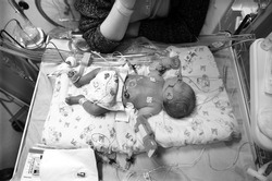 Premature baby boy delivered by Caesarean section, in Neo Natal Intensive Care Ward at Hospital