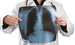 Doctor holding x-ray in front of his chest
