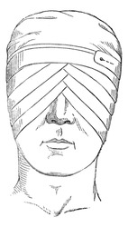 Spectacles or eye bandage crosses two globes, vintage engraved illustration. Usual Medicine Dictionary - Paul Labarthe - 1885.