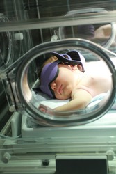 Portrait of a newborn baby with jaundice in a hospital under lights