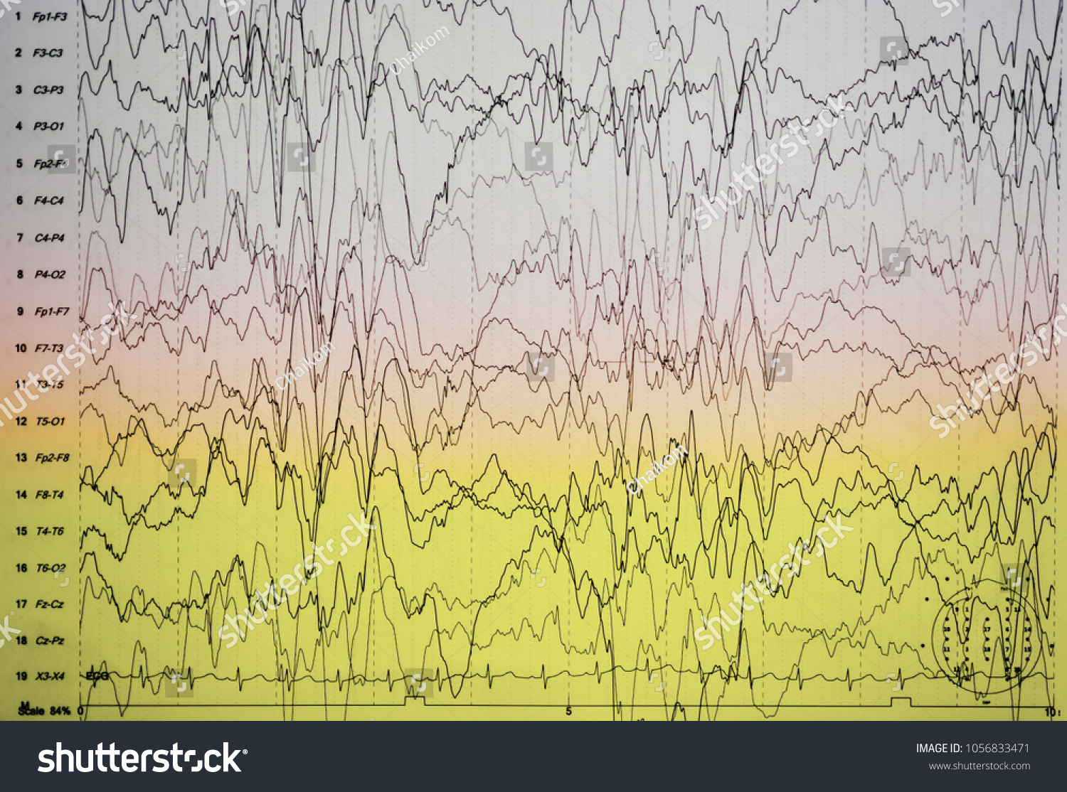 Abnormal Eeg Wave Formabnormal Eegbrain Wave库存照片1056833471 Shutterstock