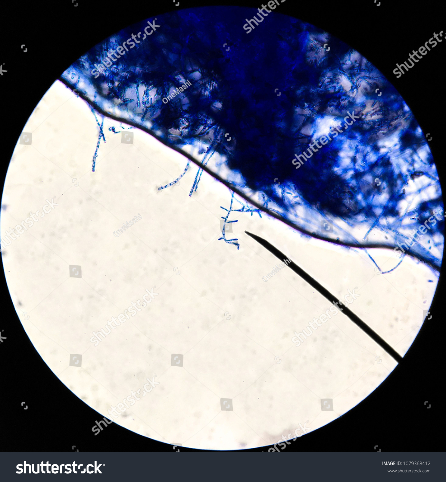 Trichophyton Spp Wet Mount Technique Stock Photo Shutterstock