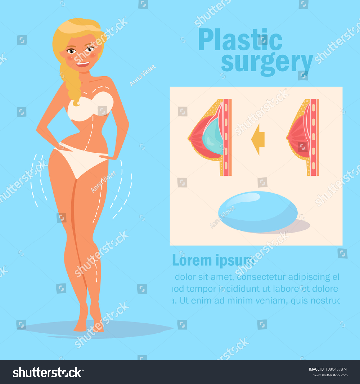 Vektor Stok Plastic Surgery Breast Vector Cartoon Isolated Tanpa