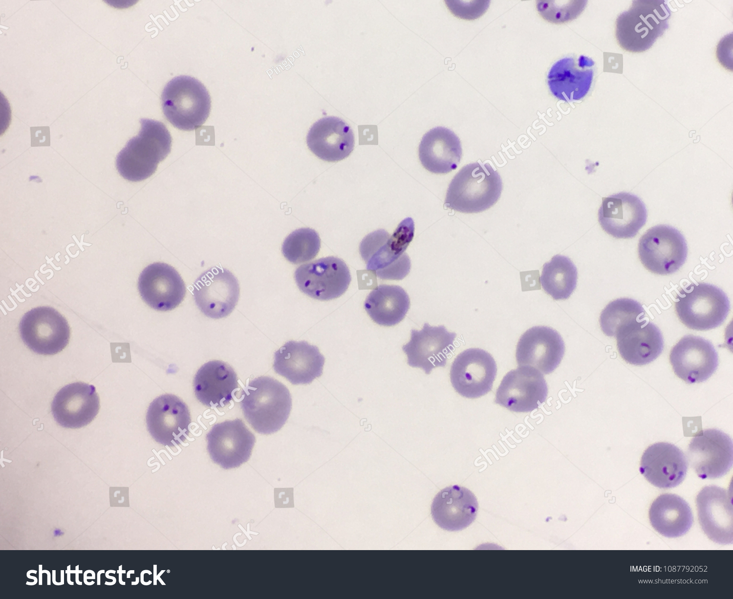 Plasmodium Falciparum Ring Form Gametocyte Thin Stock Photo