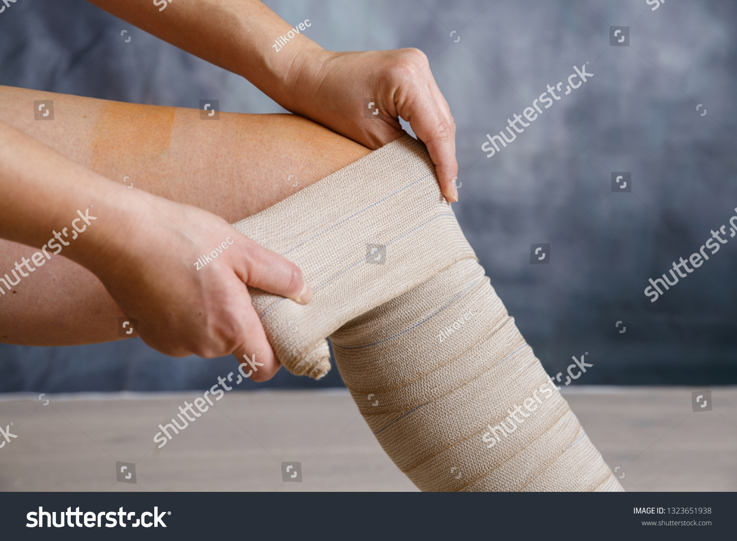 Woman Patient Varicose Veins Applying Elastic Stock Photo 1323651938