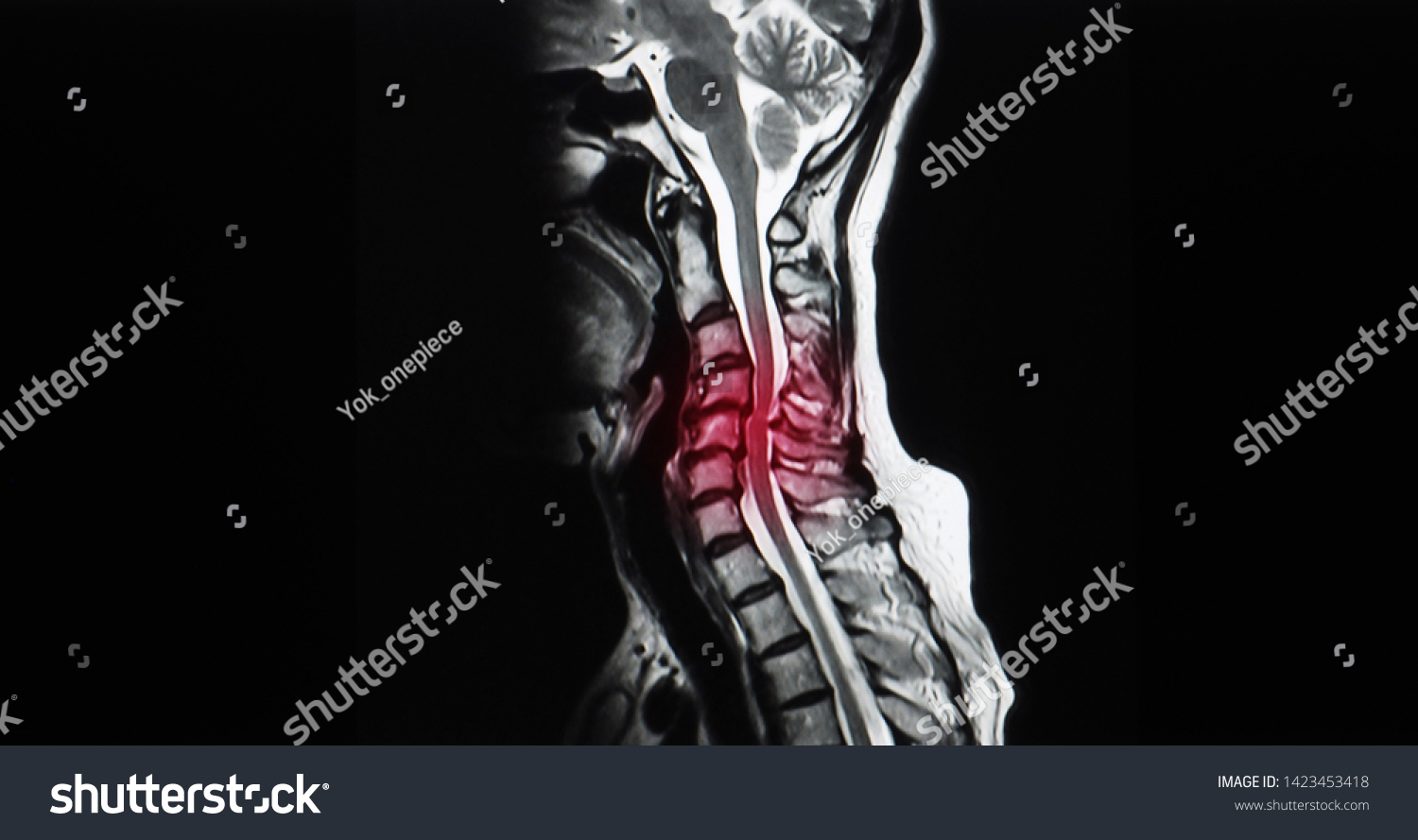 Sagittal View Magnetic Resonance Image Mri Stock Photo