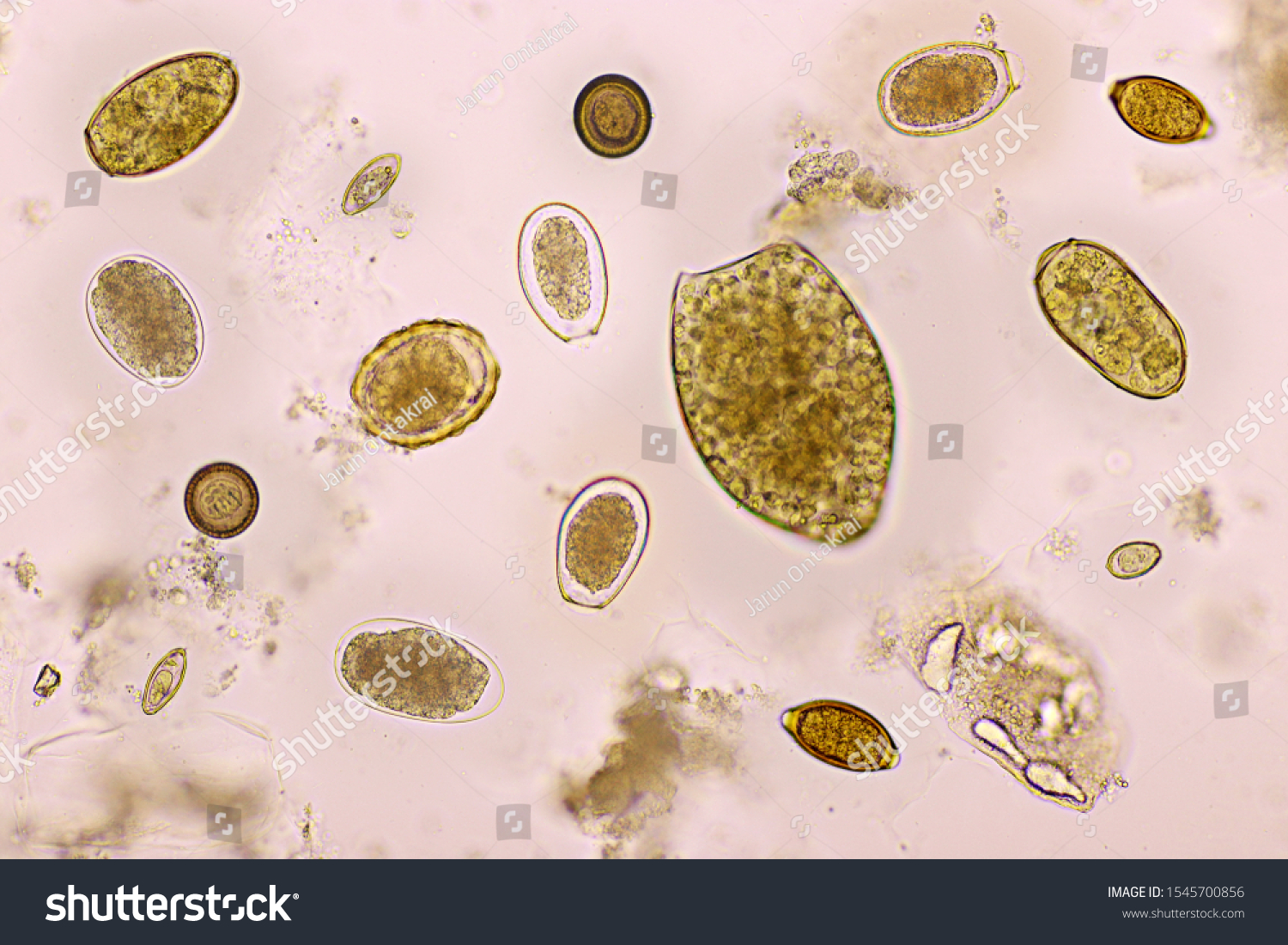 Mix Helminths Parasitic Worm Human