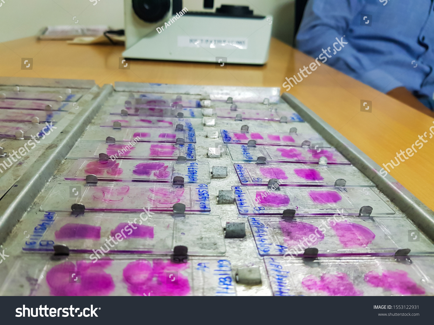 Histopathology Slides Stained Leishman Stain Displayed Stock Photo