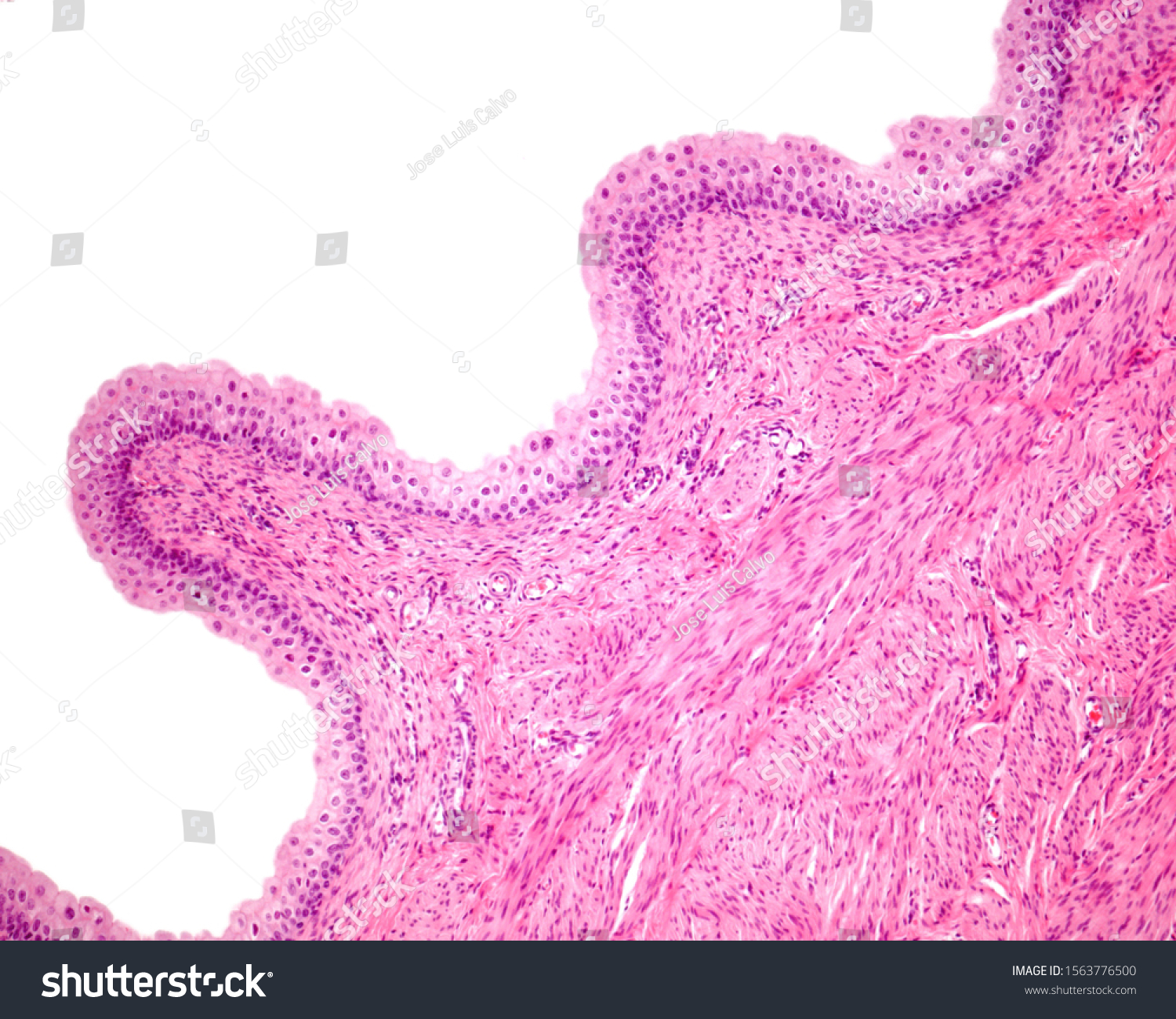 Folds Urinary Bladder Mucosa Lined By Stock Photo 1563776500 Shutterstock