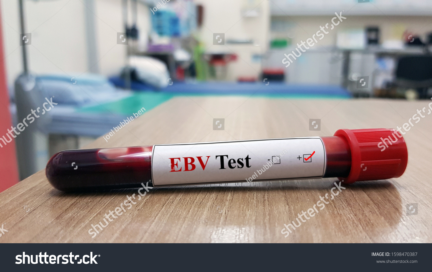 Positive Epsteinbarr Virusebvtest Laboratory Sample Blood Stock Photo