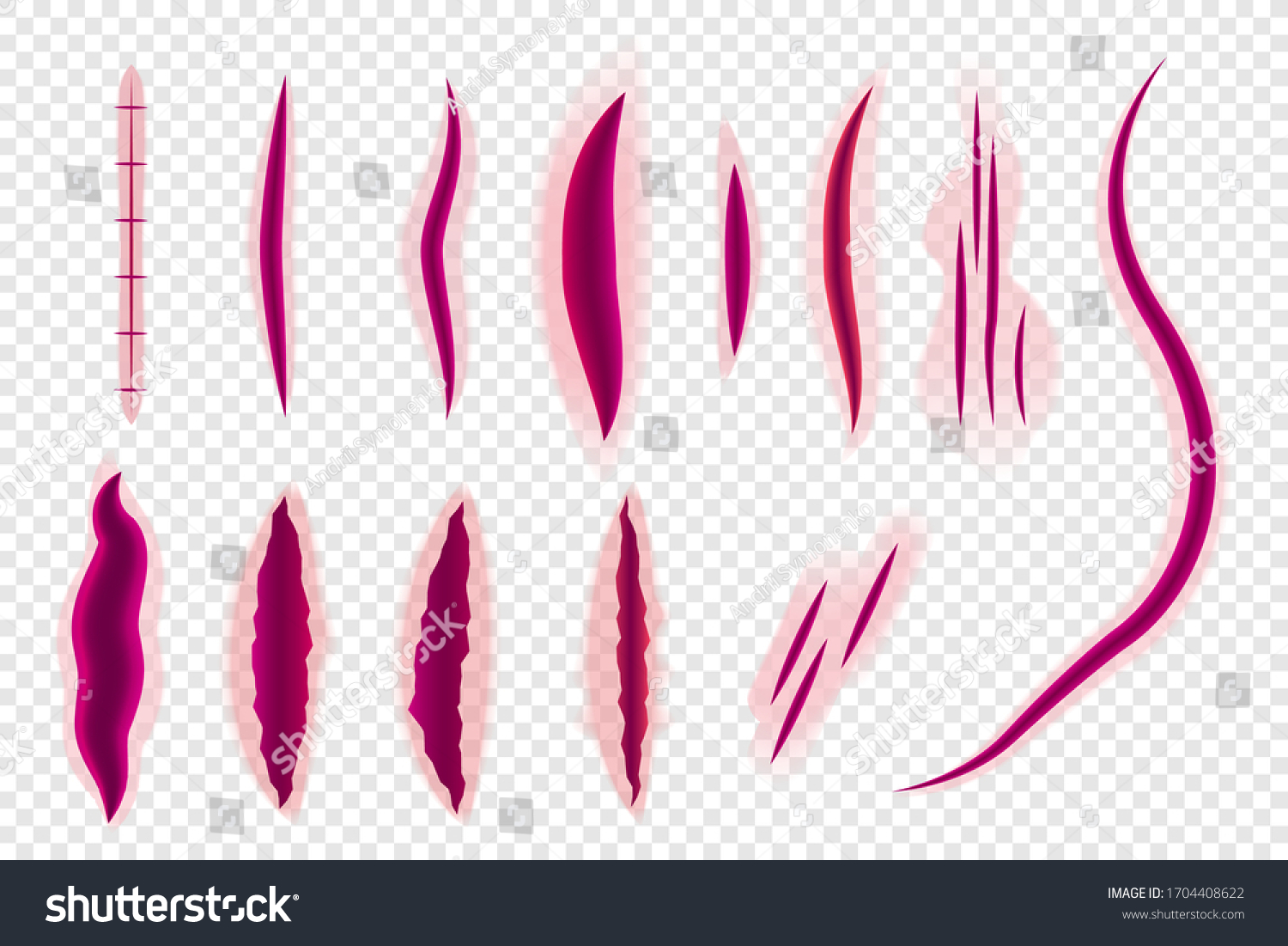 Bloody Scar Realistic Wounds Stitch Skin Stock Vector Royalty Free