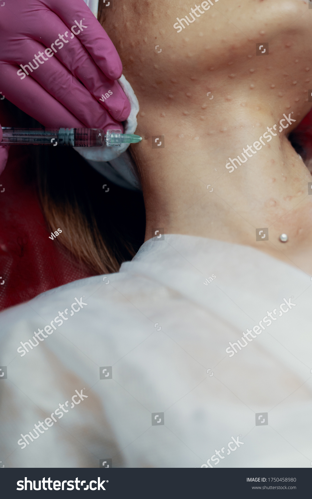 Beautician Doctor Botulinum Toxin Syringe Making Stock Photo