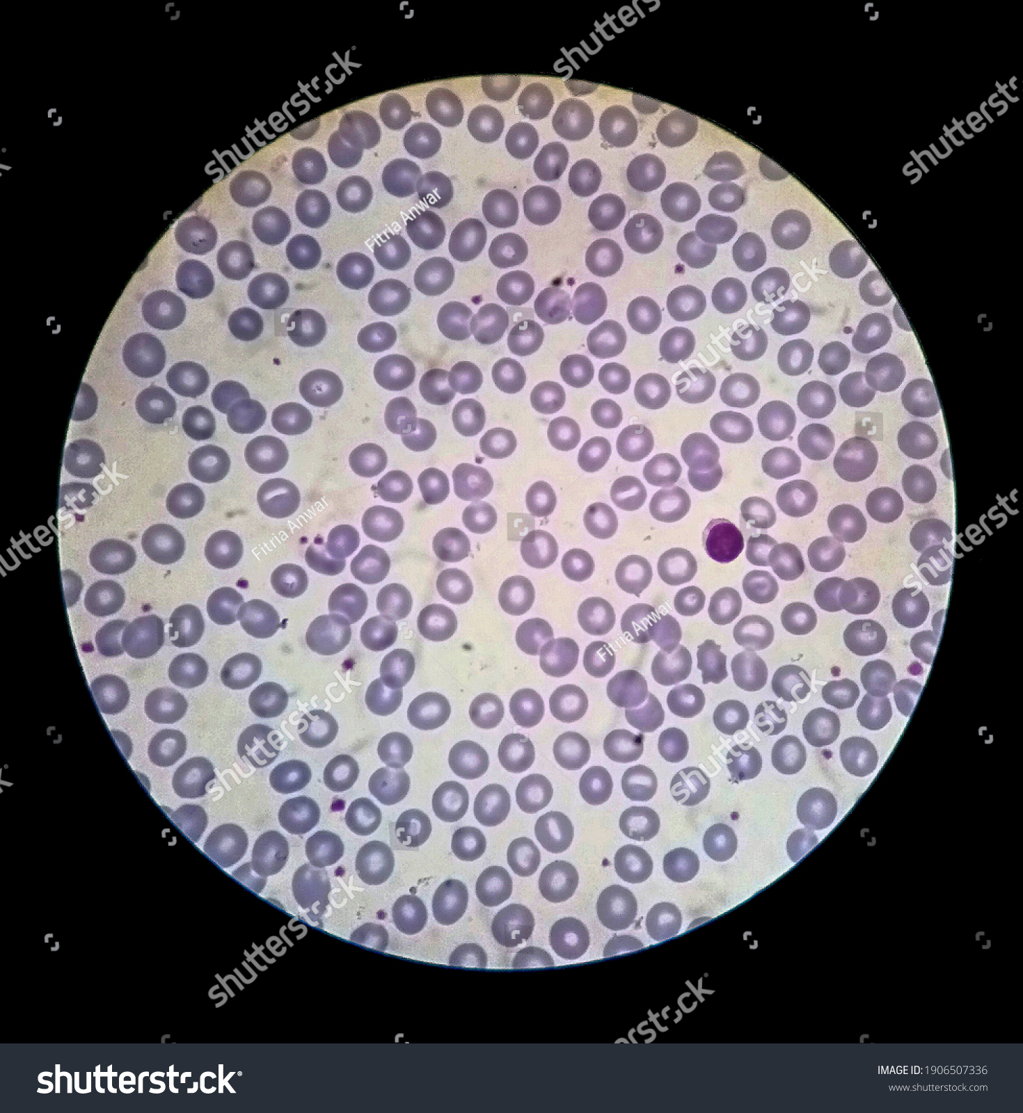 Appearance Normal Lymphocytes Under Microscope Stock Photo 1906507336