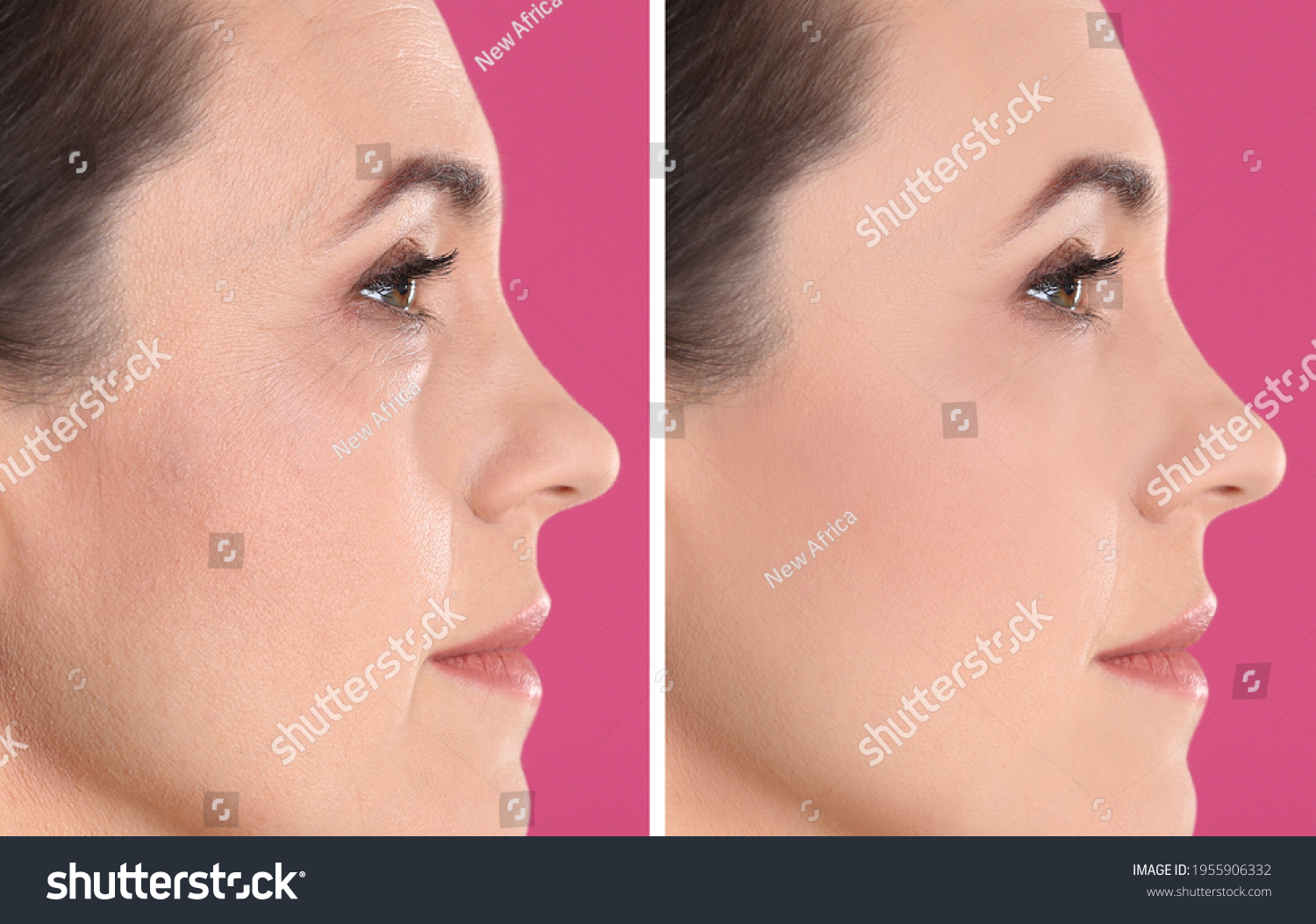 Collage Photos Mature Woman Before After Stock Photo