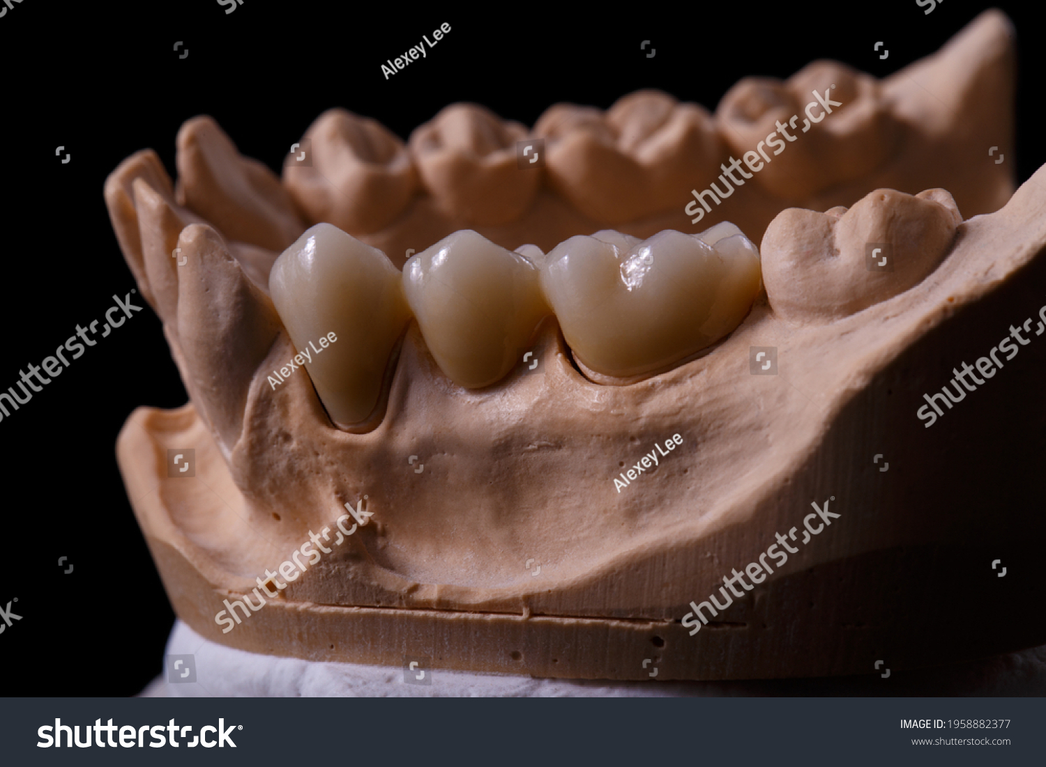 Mold Teeth Gypsum Model Plaster Teeth库存照片1958882377 Shutterstock