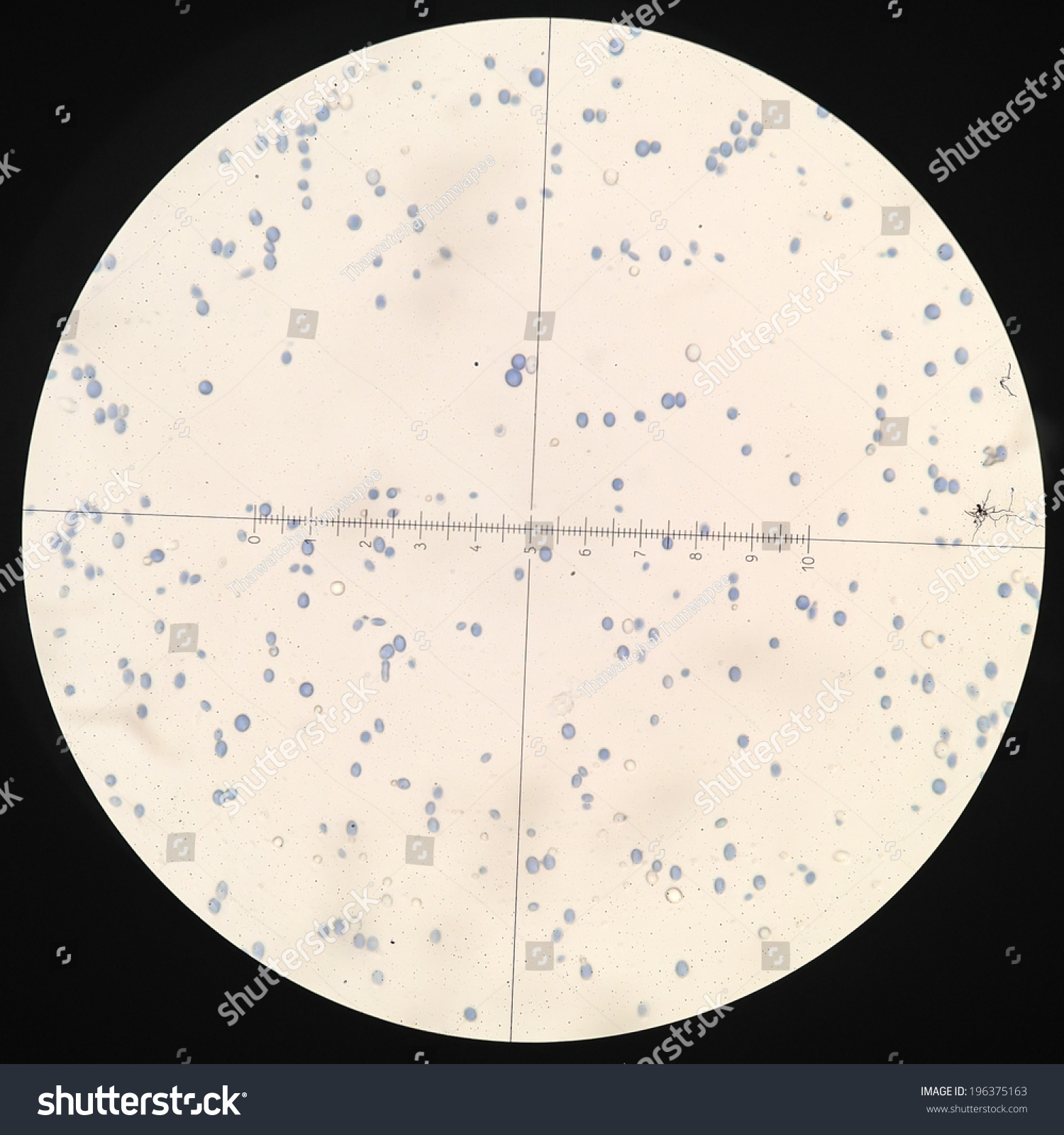 Cytology Smear Pleural Effusion Showing Candida Stock Foto 196375163