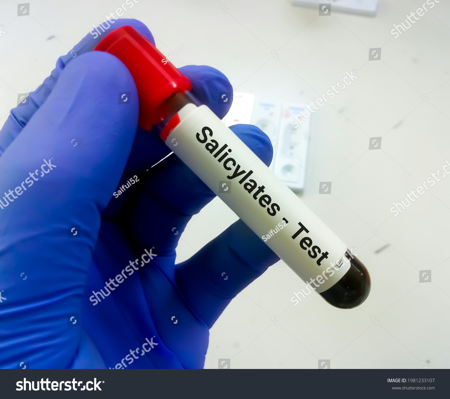 Biochemist Scientist Hold Blood Sample Salicylate Stock Photo