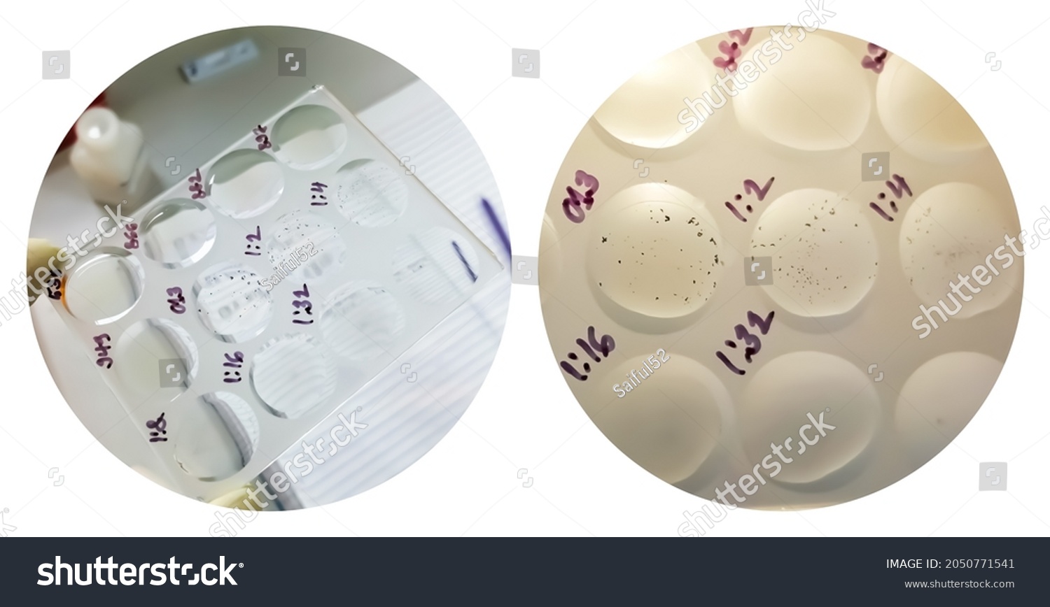 Rpr Vdrl Syphilis Test Glass Slide Stock Photo Shutterstock