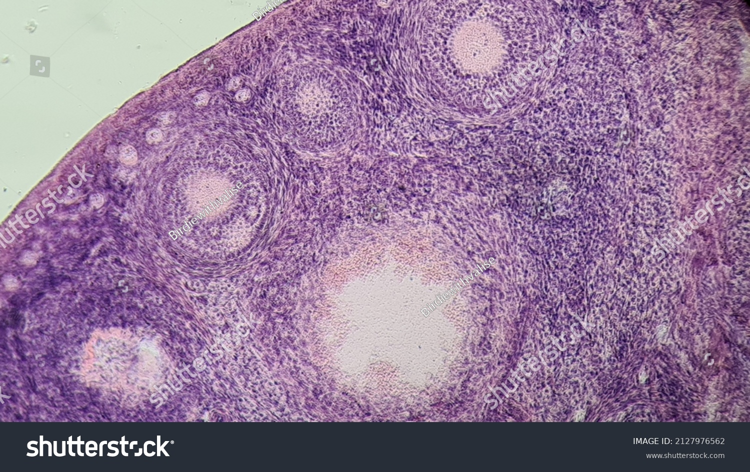 Section Mammalian Ovary Under Microscope Follicles Stock Photo