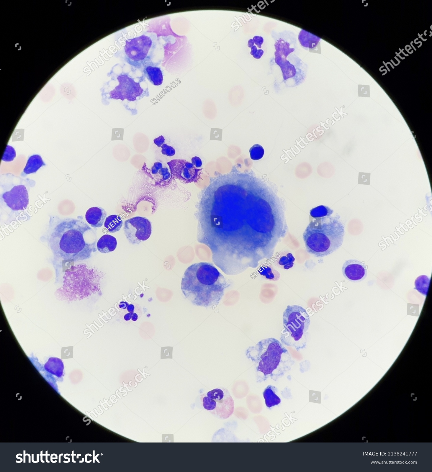 Abnormal Cell Body Fluid X Stock Photo Shutterstock