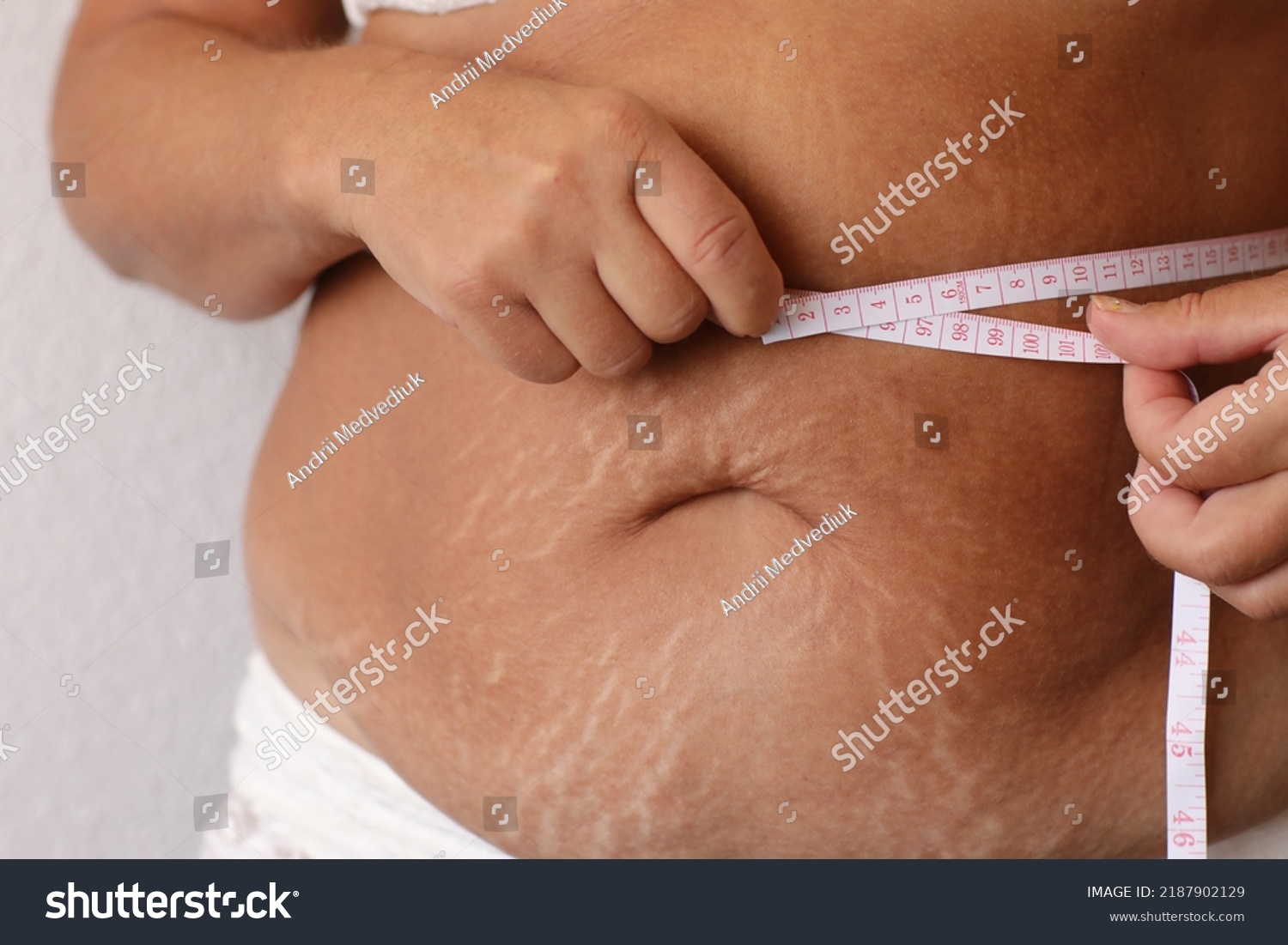 Cropped Photo Naked Overweight Woman Belly Stock Photo Shutterstock