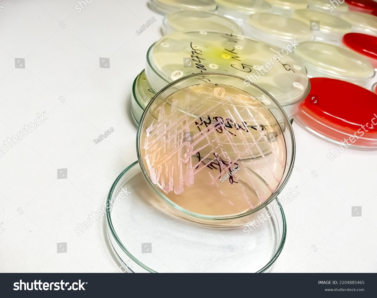 Petri Dish Bacterial Colony Isolated Background Stock Photo 2204885465