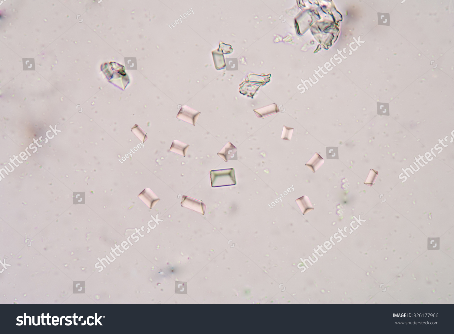 Triple Phosphate Crystal Urine Sediment Stock Photo 326177966