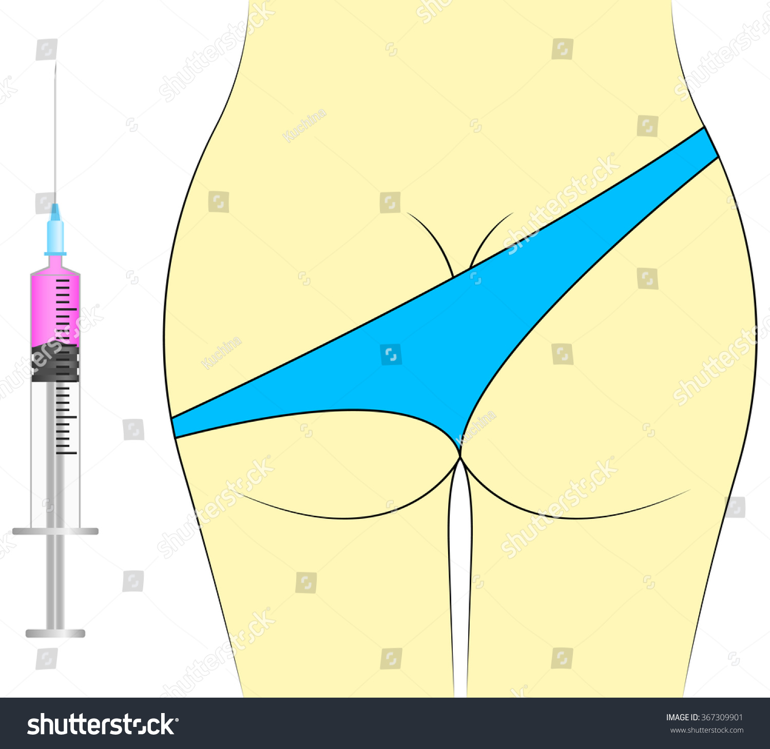 Im injection butt ass shot needle
