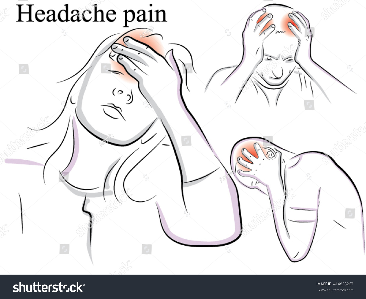 Severe head pain immediately following orgasm