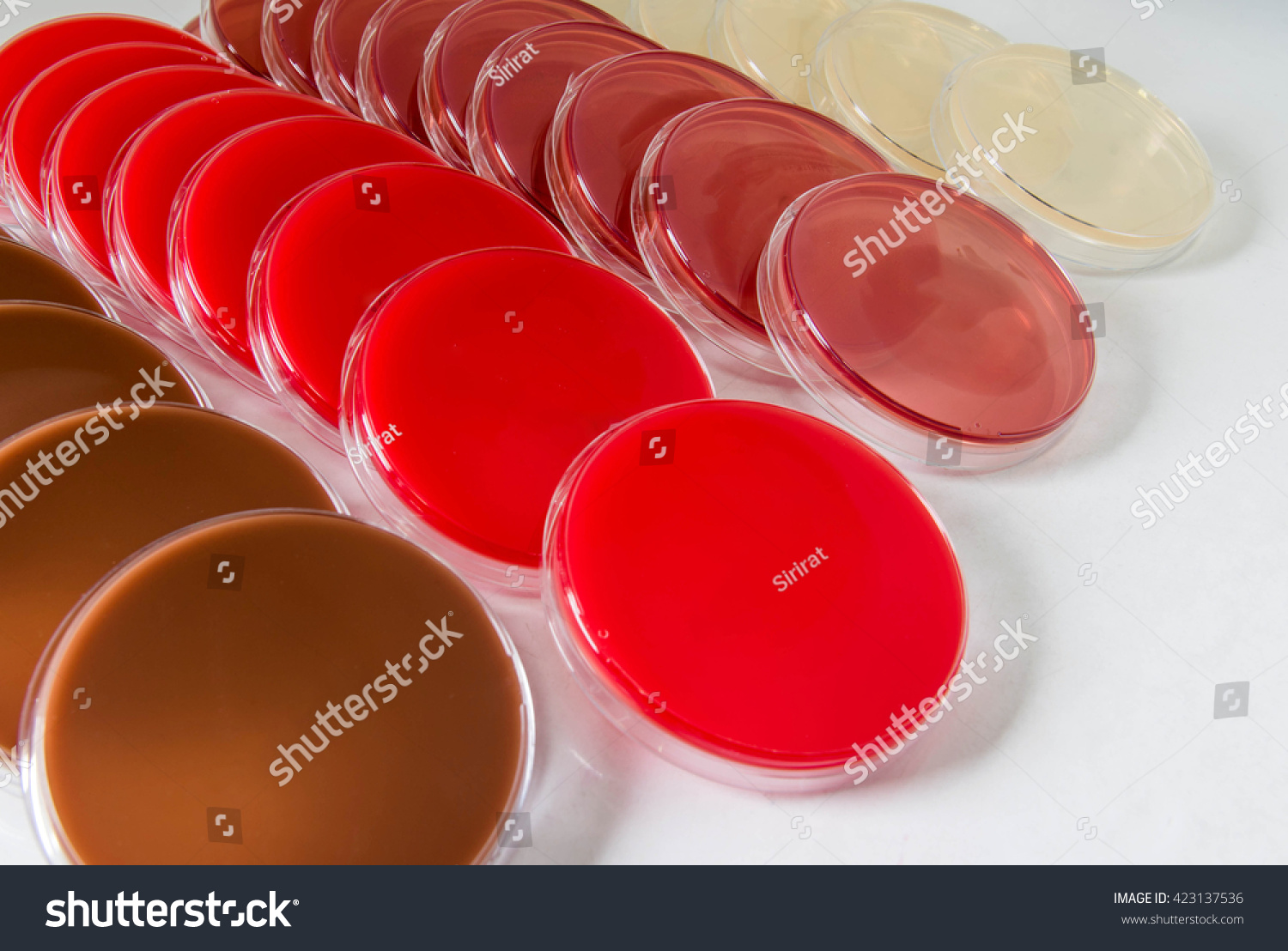 Blood Agarba Chocolate Agarca Macconkey Agarmac Shutterstock