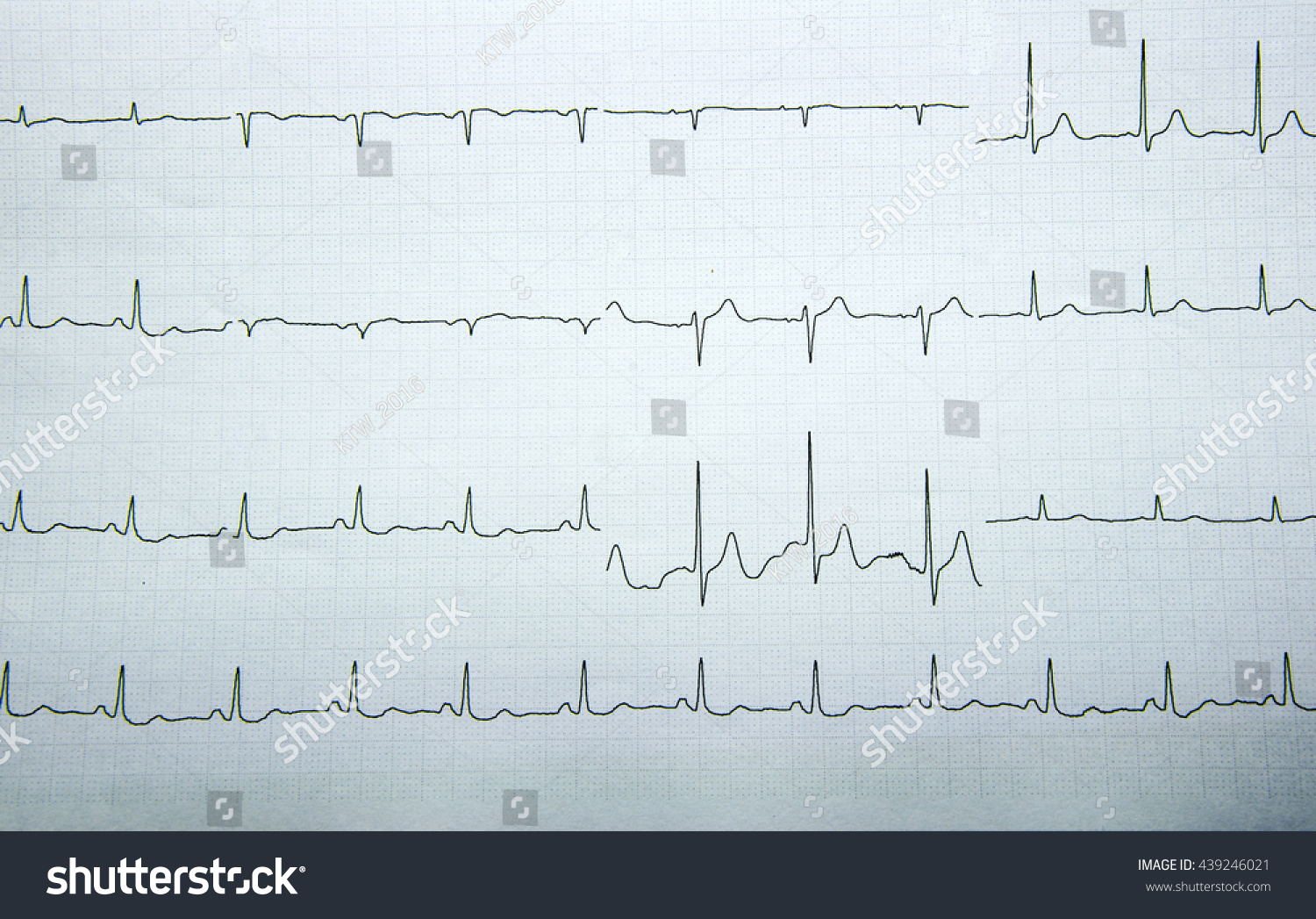 Cardiogram Waveform Ekg Test Stock Photo Shutterstock